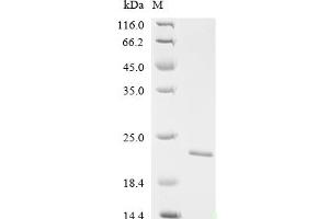 Fibroblast Growth Factor 7 (FGF7) (AA 32-194) protein