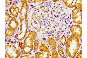 Immunohistochemistry of paraffin-embedded human kidney tissue using ABIN7170770 at dilution of 1:100 (CYP27A1 Antikörper  (AA 290-407))