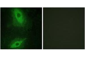 Immunofluorescence analysis of HeLa cells, using TNFSF15 Antibody. (TNFSF15 Antikörper  (AA 181-230))