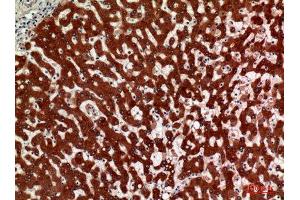 Immunohistochemistry (IHC) image for anti-Hydroxysteroid (11-Beta) Dehydrogenase 1 (HSD11B1) (Internal Region) antibody (ABIN3181414)