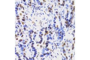 Immunohistochemistry (Paraffin-embedded Sections) (IHC (p)) image for anti-Hepatoma-Derived Growth Factor (HDGF) (AA 1-240) antibody (ABIN6141694)
