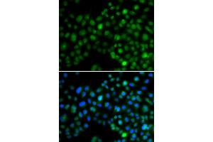 Immunofluorescence analysis of MCF-7 cells using NFIL3 antibody. (NFIL3 Antikörper)