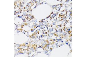 Immunohistochemistry (IHC) image for anti-Ubiquitin Specific Peptidase 33 (USP33) (AA 290-400) antibody (ABIN7271157)
