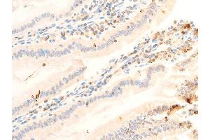 Immunohistochemistry (IHC) image for anti-Janus Kinase 1 (JAK1) (pTyr1022), (pTyr1023) antibody (ABIN6255762)