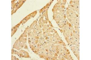 Immunohistochemistry of paraffin-embedded human heart tissue using ABIN7158825 at dilution of 1:100 (Lysozyme-Like 1 Antikörper  (AA 1-194))