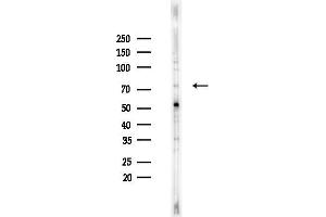 anti-Cleft Lip and Palate Associated Transmembrane Protein 1 (CLPTM1) (Internal Region) antibody