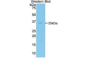 Western Blotting (WB) image for anti-Ectonucleotide Pyrophosphatase/phosphodiesterase 2 (ENPP2) (AA 637-905) antibody (ABIN1858722) (ENPP2 Antikörper  (AA 637-905))