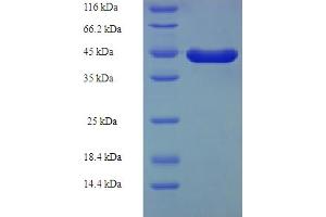 SDS-PAGE (SDS) image for KIT Ligand (KITLG) (AA 26-189), (KIT ligand chain), (partial) protein (GST tag) (ABIN5709807)
