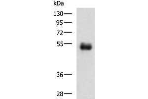 Western blot analysis of Human colorectal cancer tissue lysate using METTL17 Polyclonal Antibody at dilution of 1:700 (METTL17 Antikörper)
