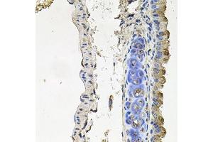 Immunohistochemistry of paraffin-embedded mouse lung using NDUFA6 antibody. (NDUFA6 Antikörper  (AA 35-154))