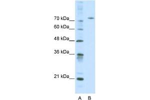 WB Suggested Anti-AFM Antibody Titration:  0. (Afamin Antikörper  (Middle Region))