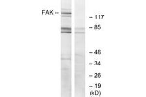 Western blot analysis of extracts from HeLa cells, treated with EGF, using FAK (Ab-925) Antibody. (FAK Antikörper  (AA 892-941))