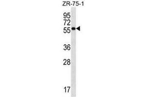 NR1D2 Antibody (Center) western blot analysis in ZR-75-1 cell line lysates (35µg/lane). (NR1D2 Antikörper  (Middle Region))