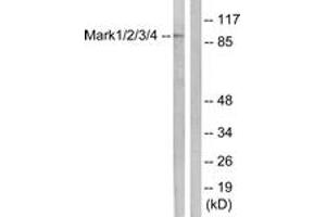 Western blot analysis of extracts from COS7 cells, using MARK1/2/3/4 (Ab-215) Antibody. (MARK1/2/3/4 Antikörper  (AA 181-230))