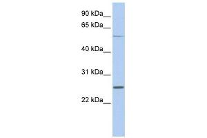 SCN1B antibody used at 1 ug/ml to detect target protein. (SCN1B Antikörper  (Middle Region))