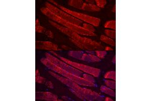 Immunofluorescence analysis of rat skeletal muscle cells using MYH4 Rabbit pAb (ABIN7268749) at dilution of 1:100 (40x lens). (MYH4 Antikörper  (AA 1450-1550))