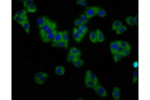 Immunofluorescence staining of HepG2 cells with ABIN7163940 at 1:133, counter-stained with DAPI. (KCNT1 Antikörper  (AA 1026-1230))