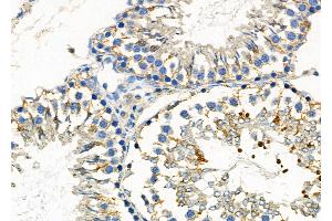 ABIN6265481 and ABIN6272441 at 1/100 staining Rat testis tissue by IHC-P.