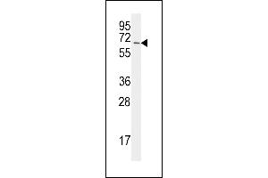 The anti-UBA2 C-term  Antibody (ABIN387913 and ABIN2844315) is used in Western blot to detect UBA2 in Jurkat lysate. (UBA2 Antikörper  (C-Term))