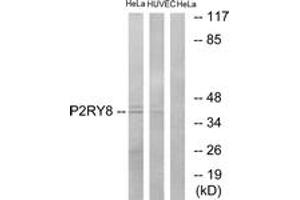 Western Blotting (WB) image for anti-Purinergic Receptor P2Y, G-Protein Coupled, 8 (P2RY8) (AA 192-241) antibody (ABIN2891068) (P2RY8 Antikörper  (AA 192-241))