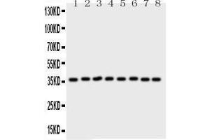 Western Blotting (WB) image for anti-Annexin A5 (ANXA5) (AA 2-320) antibody (ABIN3043502) (Annexin V Antikörper  (AA 2-320))