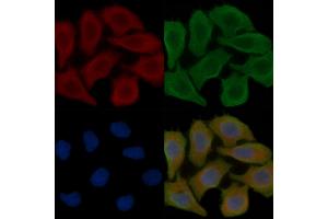 ABIN7096048 and ABIN7100110 staining Hela cells(30 min of UV treatment) by IF/ICC. (WDR73 Antikörper)