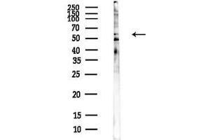 Western blot analysis of lysates from EC304 cells(heat-shock, 45 min treatment), using SLC24 Antibody at 1/1000 dilution.