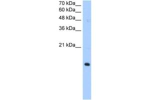 Western Blotting (WB) image for anti-Paired Immunoglobin-Like Type 2 Receptor alpha (PILRA) antibody (ABIN2463032) (PILRA Antikörper)
