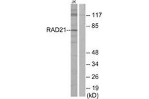 Western blot analysis of extracts from Jurkat cells, using RAD21 Antibody. (RAD21 Antikörper  (AA 521-570))