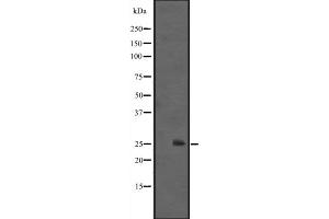 Western blot analysis of IL1F6 expression in HEK293 cells ,The lane on the left is treated with the antigen-specific peptide.