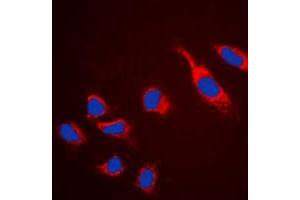 Immunofluorescent analysis of Claudin 5 staining in HeLa cells. (Claudin 5 Antikörper  (C-Term))