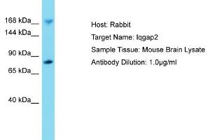 Host: Rabbit Target Name: IQGAP2 Sample Tissue: Mouse Brain Antibody Dilution: 1ug/ml (IQGAP2 Antikörper  (C-Term))