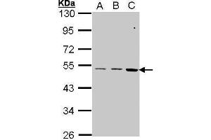 WB Image Sample (30 ug of whole cell lysate) A: A431 , B: H1299 C: Hela 10% SDS PAGE antibody diluted at 1:1000 (CCKBR Antikörper  (C-Term))
