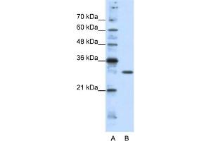 WB Suggested Anti-GSCL Antibody Titration:  1. (GSC2 Antikörper  (C-Term))