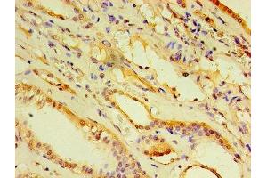 Immunohistochemistry of paraffin-embedded human kidney tissue using ABIN7143455 at dilution of 1:100 (ARF6 Antikörper  (AA 1-175))