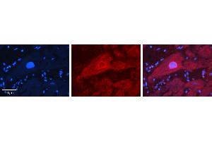 Rabbit Anti-IRF6 Antibody   Formalin Fixed Paraffin Embedded Tissue: Human heart Tissue Observed Staining: Cytoplasmic, nucleus Primary Antibody Concentration: N/A Other Working Concentrations: 1:600 Secondary Antibody: Donkey anti-Rabbit-Cy3 Secondary Antibody Concentration: 1:200 Magnification: 20X Exposure Time: 0. (IRF6 Antikörper  (Middle Region))