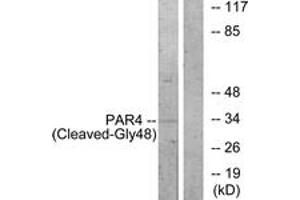 Western blot analysis of extracts from NIH-3T3 cells, treated with etoposide 25uM 1h, using PAR4 (Cleaved-Gly48) Antibody. (F2RL3 Antikörper  (Cleaved-Gly48))