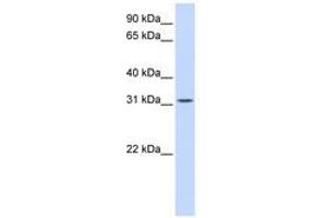 Image no. 1 for anti-Breast Carcinoma Amplified Sequence 2 (BCAS2) (C-Term) antibody (ABIN6740686) (BCAS2 Antikörper  (C-Term))