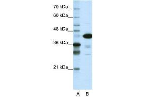 WB Suggested Anti-TARDBP  Antibody Titration: 1. (TARDBP Antikörper  (N-Term))