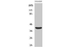 Western Blotting (WB) image for anti-Siah E3 Ubiquitin Protein Ligase 2 (SIAH2) (C-Term) antibody (ABIN3177413) (SIAH2 Antikörper  (C-Term))