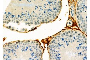 ABIN6265680 and ABIN6278645 at 1/100 staining Mouse testis tissue by IHC-P. (TP53INP1 Antikörper  (Internal Region))