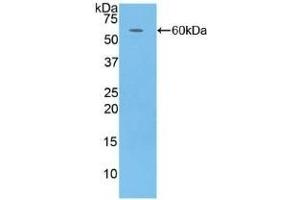 Detection of Recombinant CFD, Human using Polyclonal Antibody to Complement Factor D (CFD) (Adipsin Antikörper  (AA 1-253))