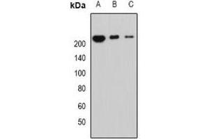 Western blot analysis of Periplakin expression in MCF7 (A), mouse lung (B), mouse heart (C) whole cell lysates. (PPL Antikörper)