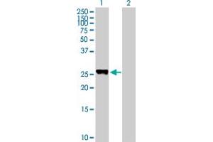 Western Blot analysis of PLEKHM1P expression in transfected 293T cell line by PLEKHM1P MaxPab polyclonal antibody. (PLEKHM1P Antikörper  (AA 1-237))