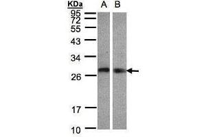 WB Image Sample(30 ug whole cell lysate) A:Hep G2 , B:Raji , 12% SDS PAGE antibody diluted at 1:1000 (LYPLA2 Antikörper)