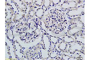 Formalin-fixed and paraffin embedded rat kidney tissue labeled with Rabbit Anti-Podoplanin/gp36 Polyclonal Antibody (ABIN736896), Unconjugated 1:200 followed by conjugation to the secondary antibody and DAB staining (Podoplanin Antikörper  (AA 91-166))