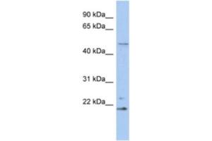 Western Blotting (WB) image for anti-Retinoblastoma Binding Protein 9 (RBBP9) antibody (ABIN2463903) (RBBP9 Antikörper)