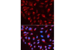 Immunofluorescence analysis of U2OS cell using CTBP1 antibody. (CTBP1 Antikörper  (AA 20-250))
