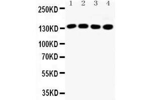 Western Blotting (WB) image for anti-Insulin Receptor Substrate 1 (IRS1) (AA 106-122), (N-Term) antibody (ABIN3042564) (IRS1 Antikörper  (N-Term))