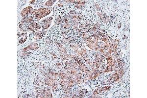 IHC analysis of COMT using anti-COMT antibody (ABIN7601948). (COMT Antikörper  (AA 52-271))